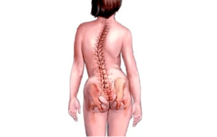 The reasons for the development of cervical osteochondrosis
