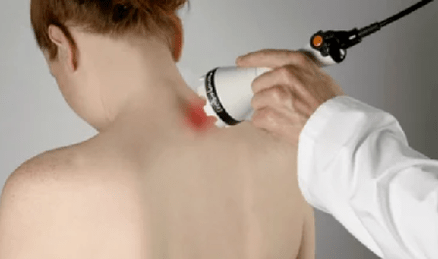 Treatment of cervical osteochondrosis by physiotherapy