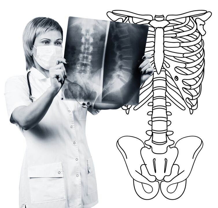 Lumbar spine radiography