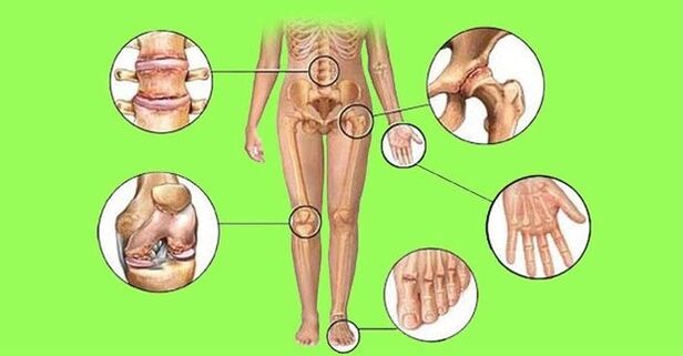 joints affected by arthritis and osteoarthritis