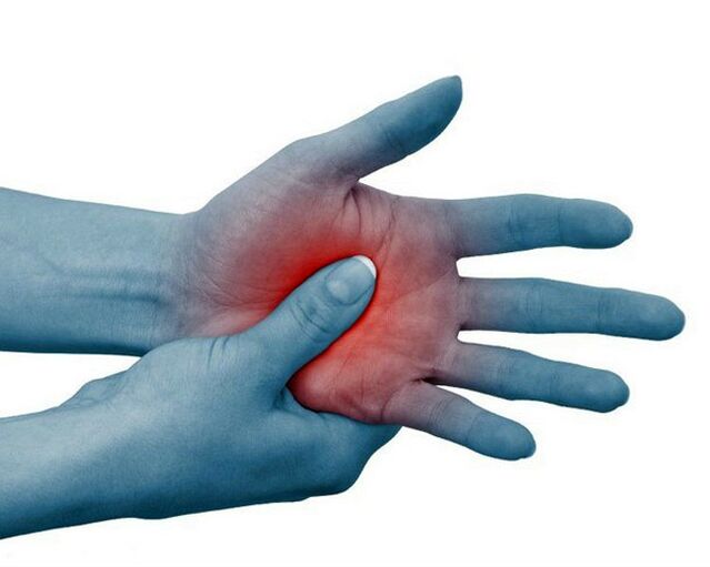 Severe pain in the finger joints, which eases with exercise, is a typical sign of rheumatoid arthritis. 